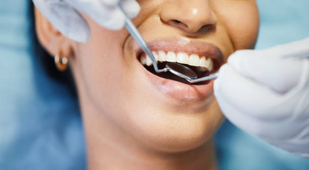 Best Emergency Broken Tooth Repair in Groveland, FL